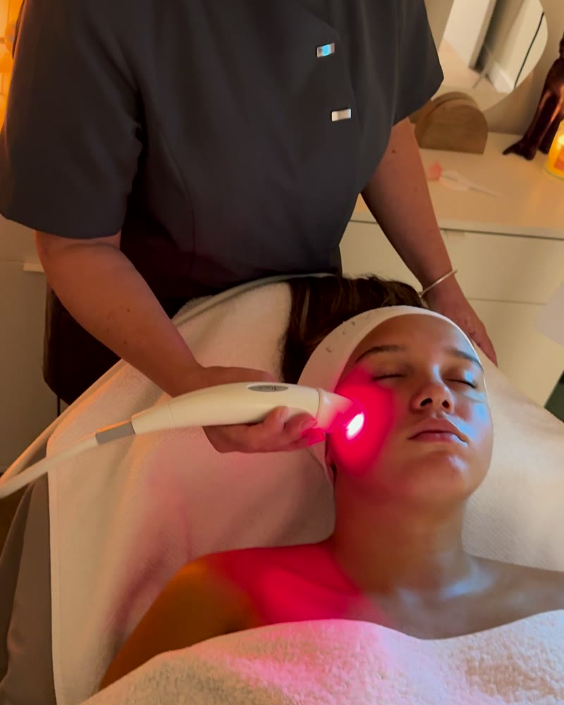 Radiofrecuencia facial T-Dynamics en la cabina de Líbera, Vila de Gràcia